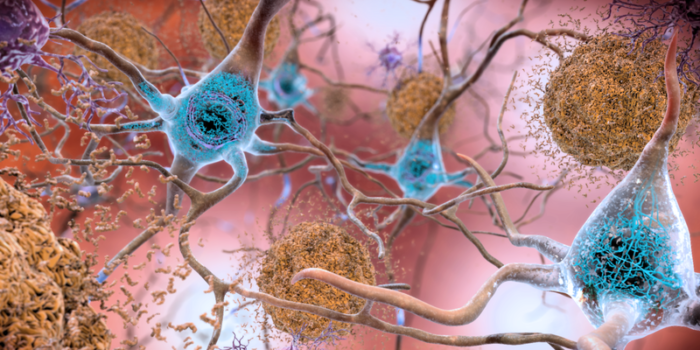 Key step forward in tackling neurodegenerative diseases