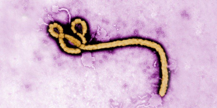 Researchers to use supercomputer to 'hack' Ebola