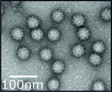 A transmission electron microscopy image of negatively-stained murine norovirus virions.