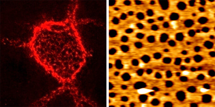 Micrograph on the left show perineuronal nets, net-like extracellular matrix structures rich in hyaluronan that surround neurons and control neuronal plasticity. Micrograph on the right shows that similar net-like morphologies can be reconstituted in vitro with surface-grafted hyaluronan and a hyaluronan cross-linking protein.