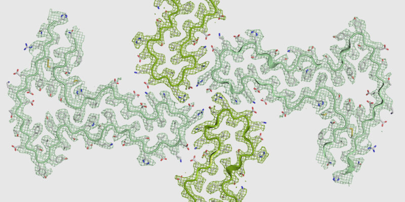 New insights into β2-microglobulin amyloid aggregation